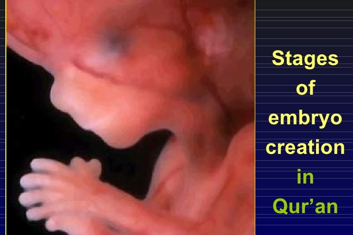 مؤتمر في باريس حول "الدراسات القرآنية في الطب"