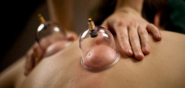ما هي فوائد الحجامة للرجال