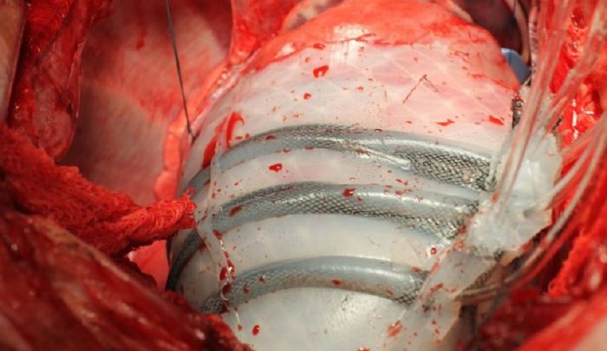 علماء بريطانيون يطورن روبوتا من مواد لينة يحاكى وظائف عضلة القلب