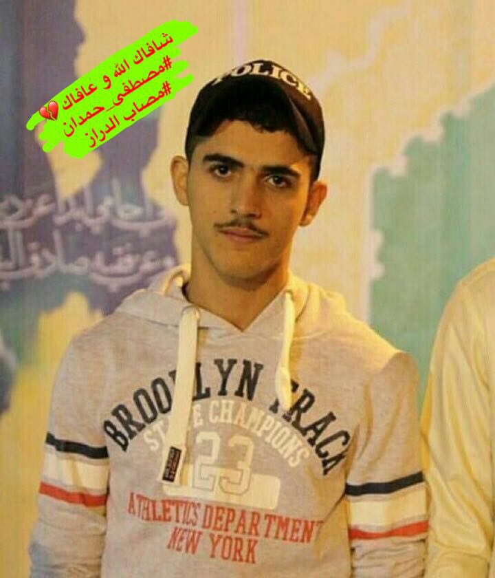 إصابة شاب بحريني في رأسه بالدراز