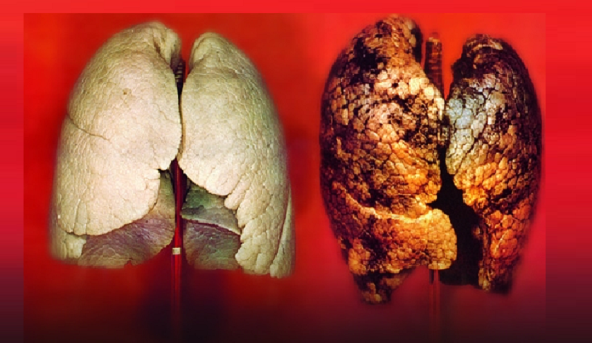 بشرى سارة... خضار ينظف الرئتين من التدخين بأسرع وقت