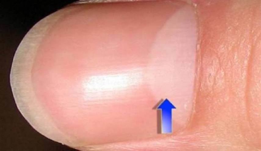 ماذا يعني وجود نصف قمر على الأظافر؟!