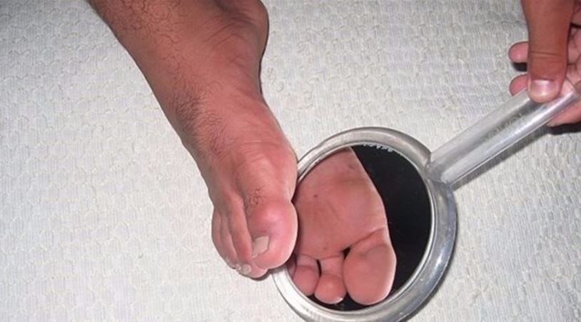 لمريض السكري .. افحص قدميك كل ليلة!