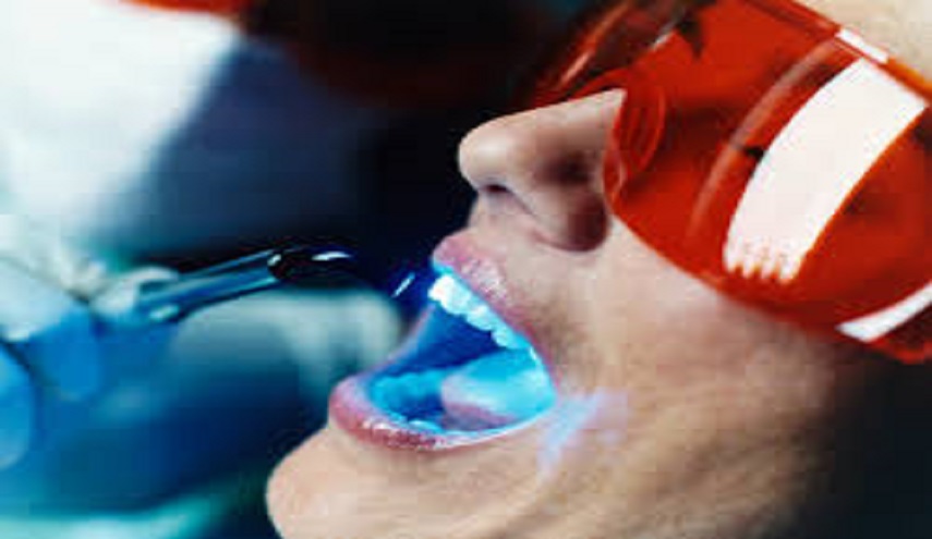 ابتعد عن تبييض الاسنان بالليزر لهذه الاسباب !!