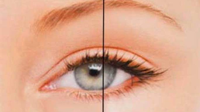 خطوة واحدة قبل النوم للتخلص من انتفاخ العين