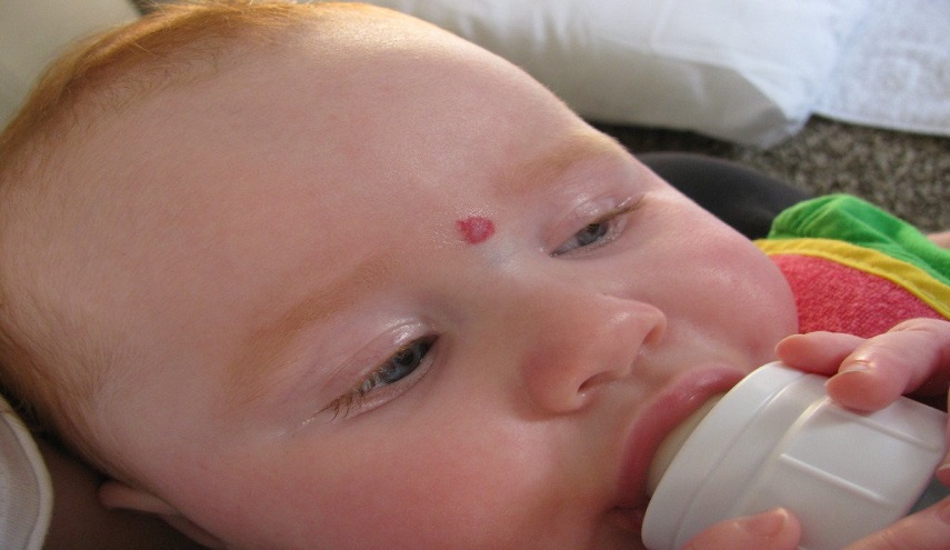 ماذا يعني وجود هذه العلامات الحمراء على جسدك؟!