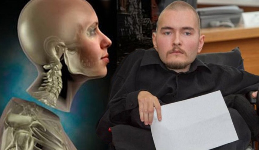 مدهش .. العالم سيشهد على أول عملية زرع رأس بشري!! 