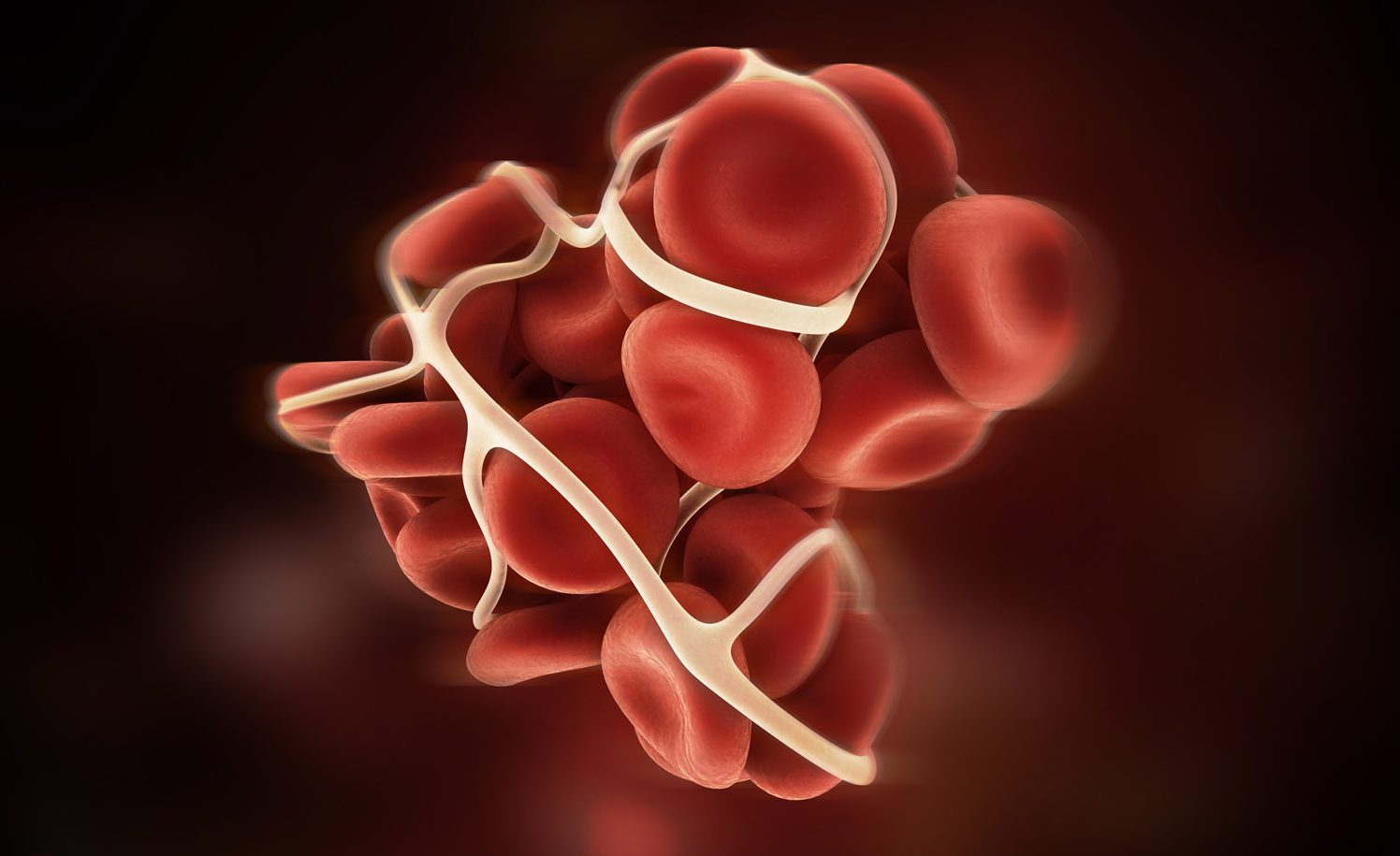 نشانه های لخته خون در بدن را بشناسیم