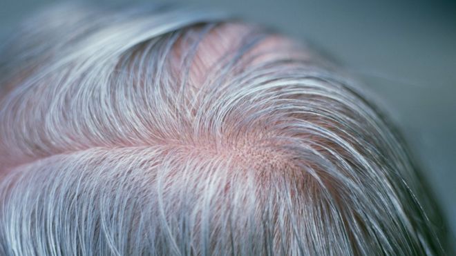 دراسة: الشيب مرتبط بأمراض القلب