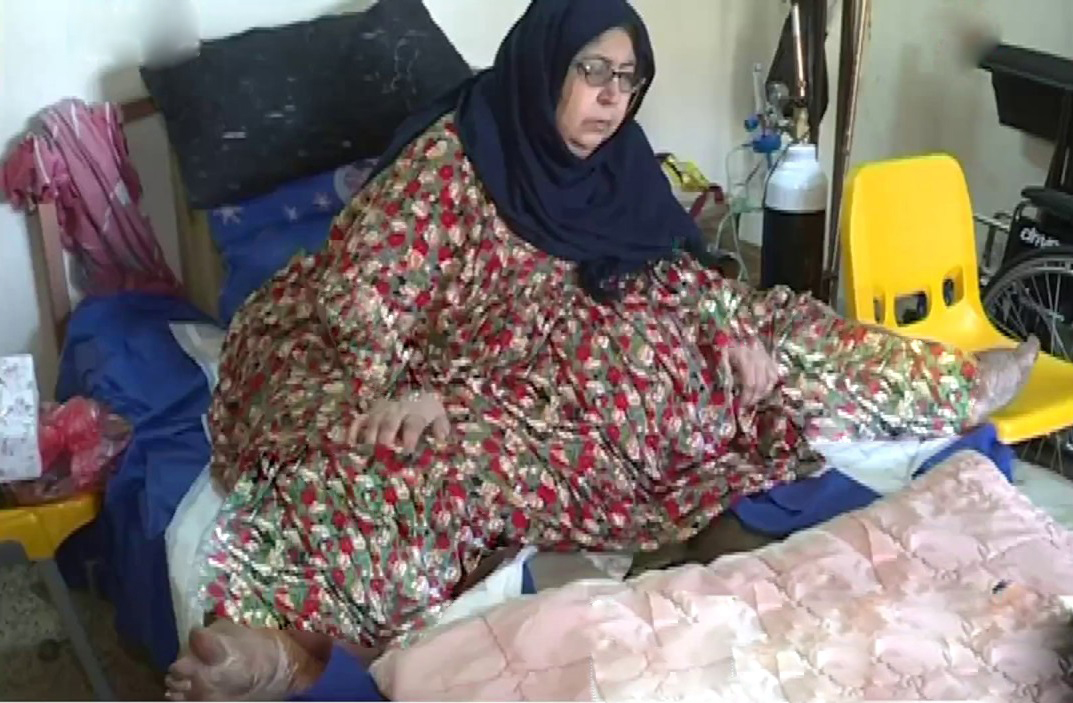 عراقية بوزن 400 كيلوغرام .. والسبب، "تشخيص طبي خاطئ"!