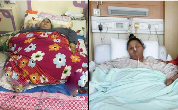 بالصور .. مفاجآت فجرتها طبيبة المصرية ذات النصف طن !