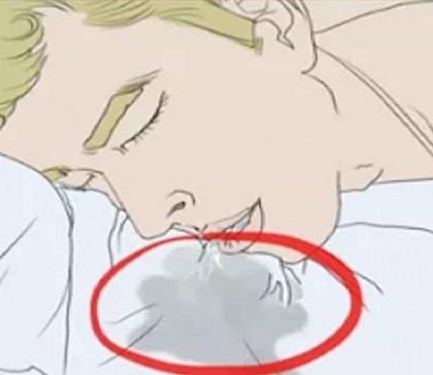 كيف نعالج "سيلان اللعاب"؟