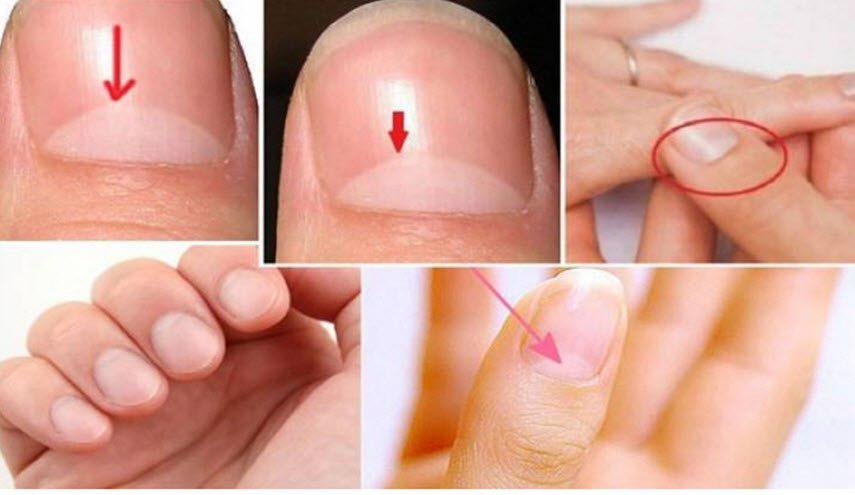 ما سر وجود هذا الهلال الأبيض على الأظافر؟