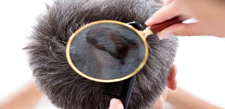 كيف تمنع ظهور الشعر الأبيض في سن الشباب؟‎