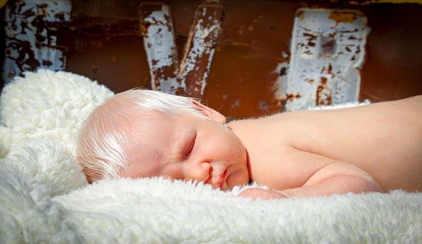 شاهد .. رضيعة بشعر ابيض تثير دهشة على الانترنت