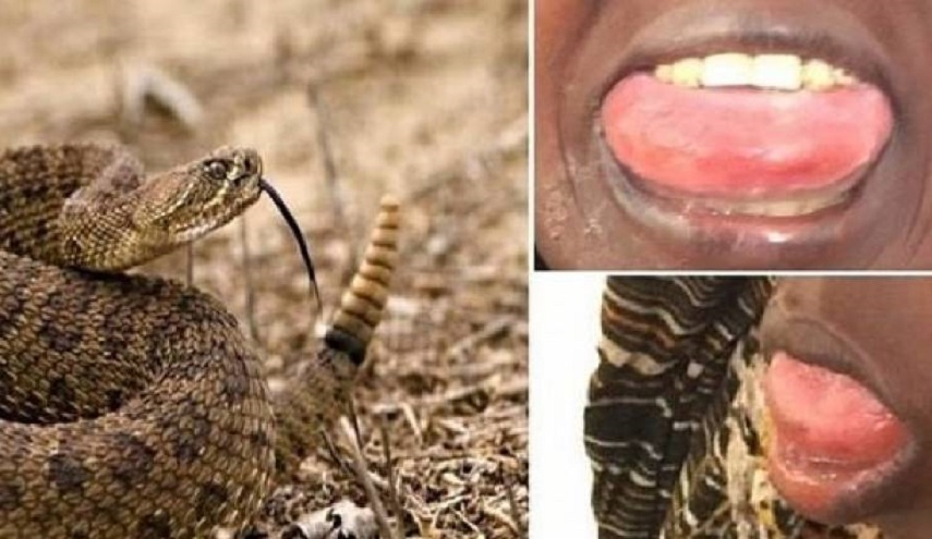 واقعة نادرة: حيّة سامة لدغت فتاة بفمها.. وما حصل معها غريب!