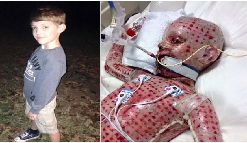 ظن الأطباء أنه طفح جلدي.. وبعد بضعة أيام اكتشفوا هذا الامر !