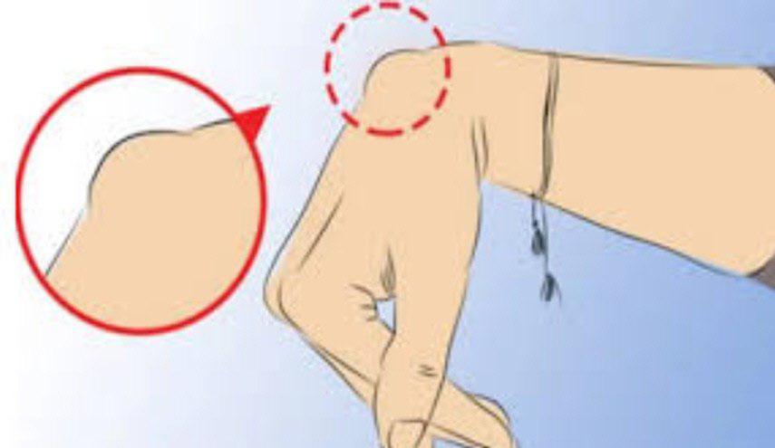 إذا ظهر هذا على معصمك.. إستشير الطبيب فوراً!