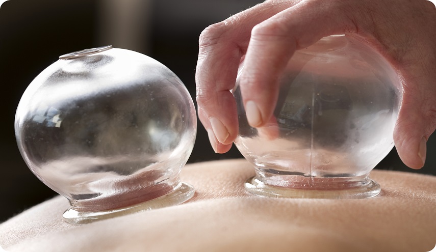 إليكم فوائد الحجامة المدهشة !