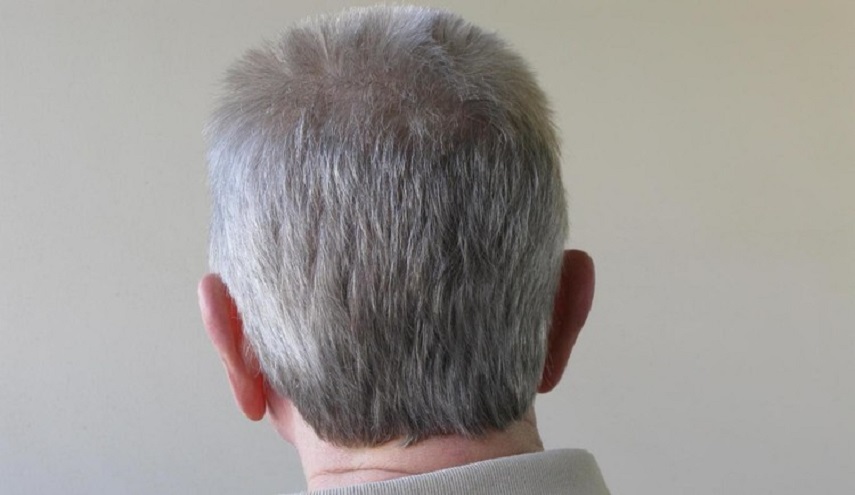 علاج للسرطان يثير حيرة العلماء، ويعيد للشعر لونه الأسود!