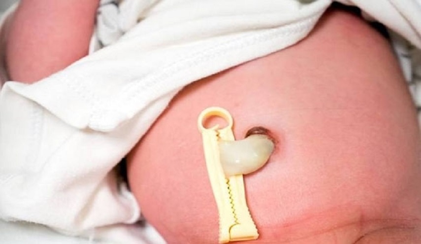 مؤسسة ايرانية تخزن عينات من دم الحبل السري للاطفال العراقيين ...السبب 