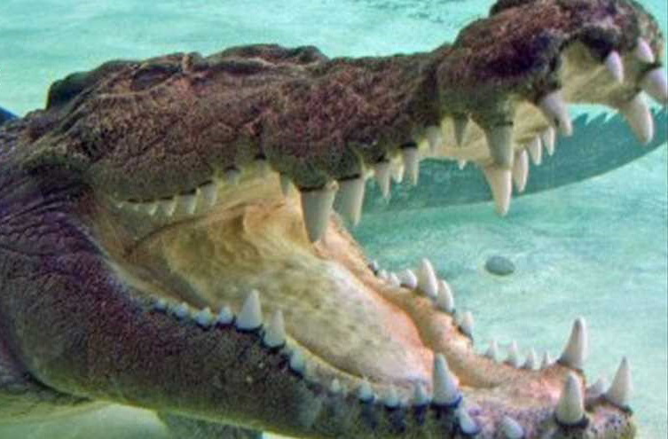 تعرف على أغرب وسائل العلاج الطبي التي كانت تستخدم سابقاً!