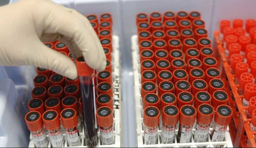 فصيلة الدم تتنبأ بإصابة الإنسان بـ5 أمراض