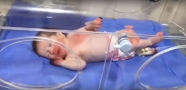  امريكية تقطع اكثر من 10000 كم لتبني الطفلة المعجزة "بتول"