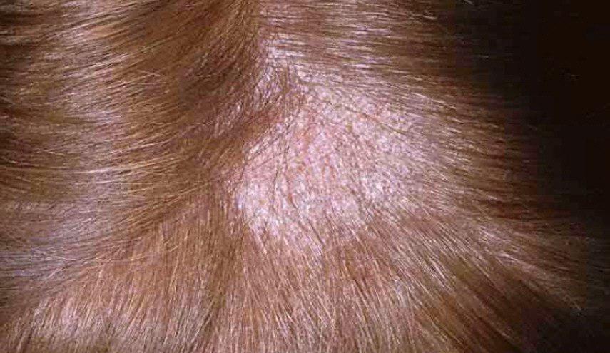 لكل من تعاني من فراغات الشعر ... اليك الحل!