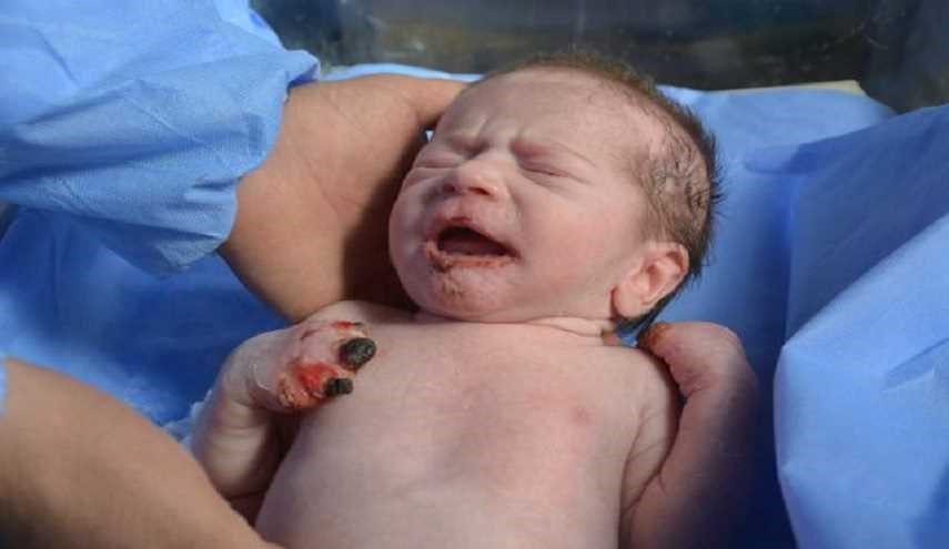 شاهد كيف اصبحت الطفلة المعجزة بعد 12 يوما في المستشفى!