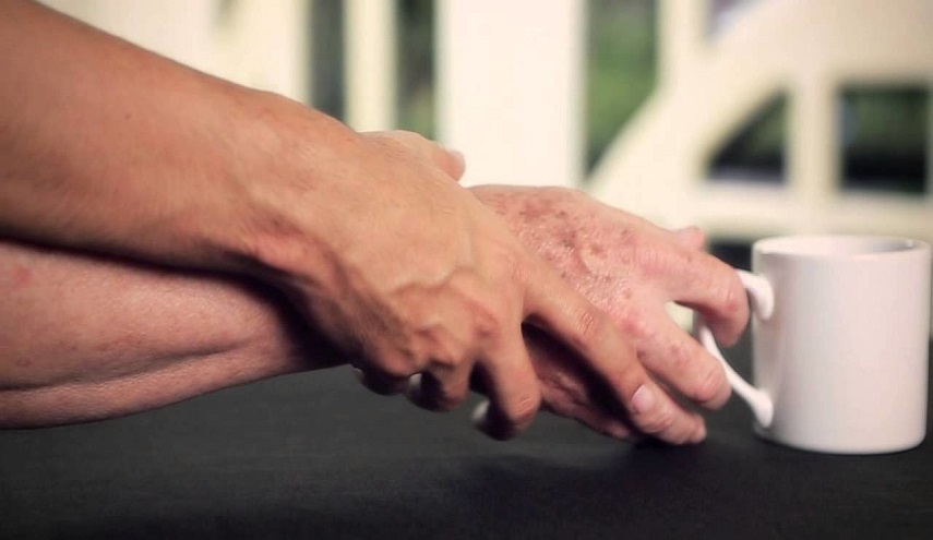 أمل جديد لمرضى "الشلل الرعاش"