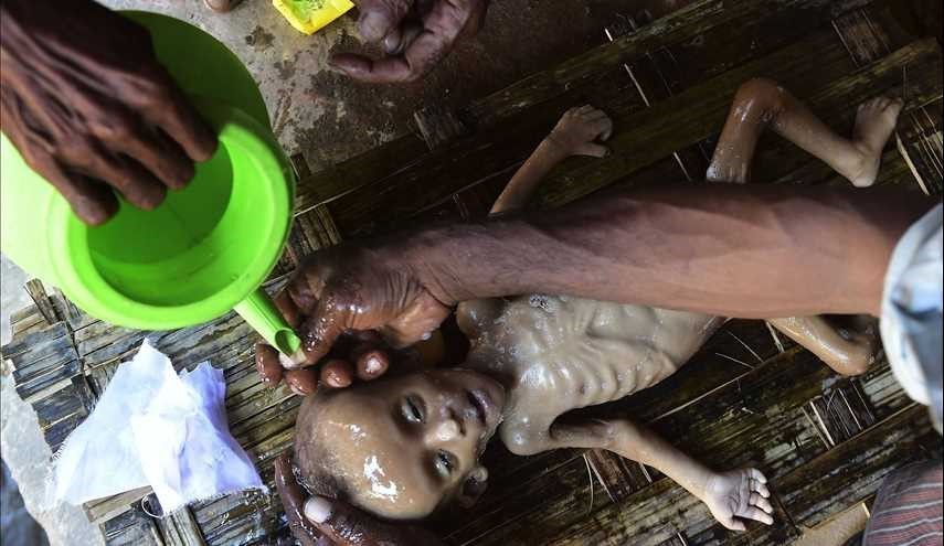 صور مؤلمة.. مسلمو ميانمار... بأي ذنب قتلت؟! (16+)