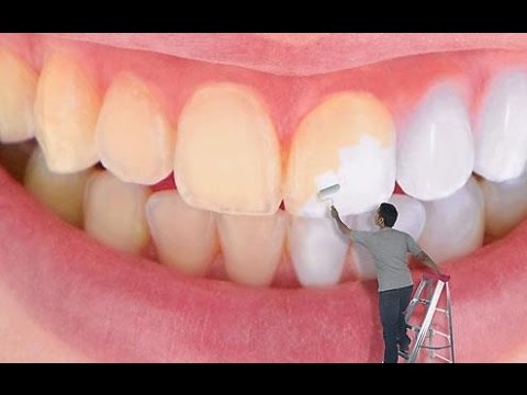 أقوى 10 أطعمة مسؤولة عن اصفرار الأسنان.. وكيفية إزالته