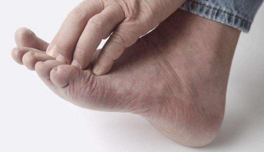 وصفة طبيعية بسيطة للتخلص من تشققات باطن القدم 