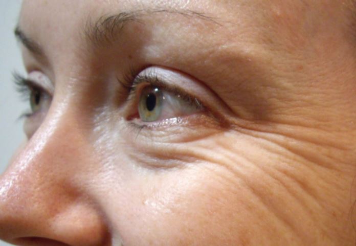 وصفة "فعالة" لشد التجاعيد أسفل العين