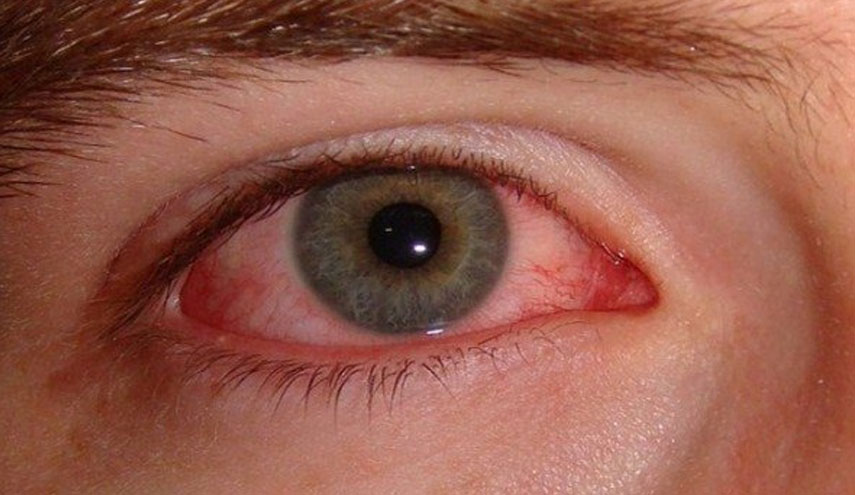 مخلوق غريب يعيش في عين فتى حير العلماء!