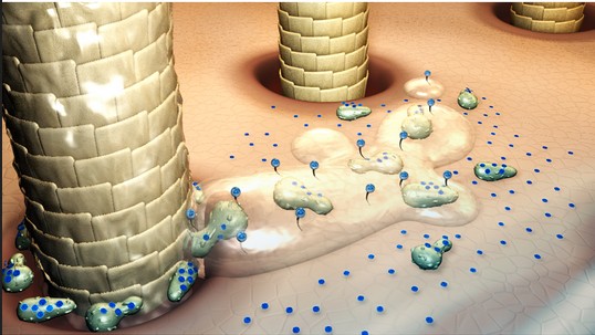 قشرة الرأس .. أسبابها وعلاجها بأسهل الطرق!