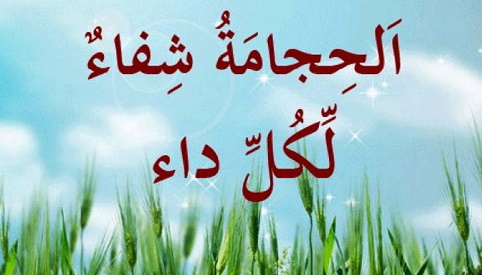 چه زمان‌هايي براي حجامت مناسب است؟