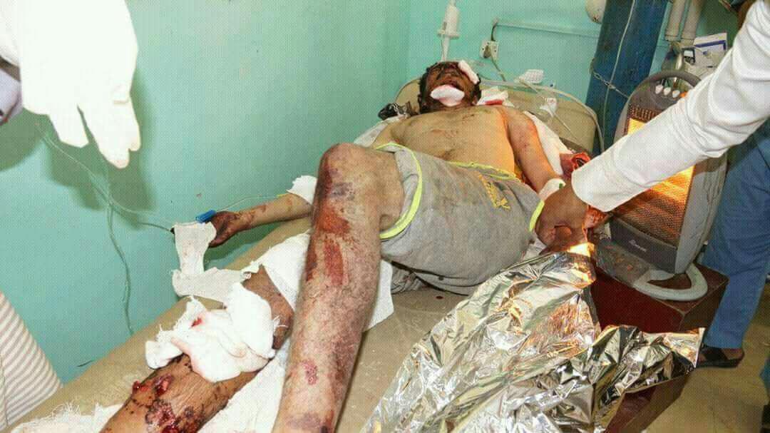 صور مروعة.. أجساد ممزقة بفعل غارة سعودية على صعدة (16+)