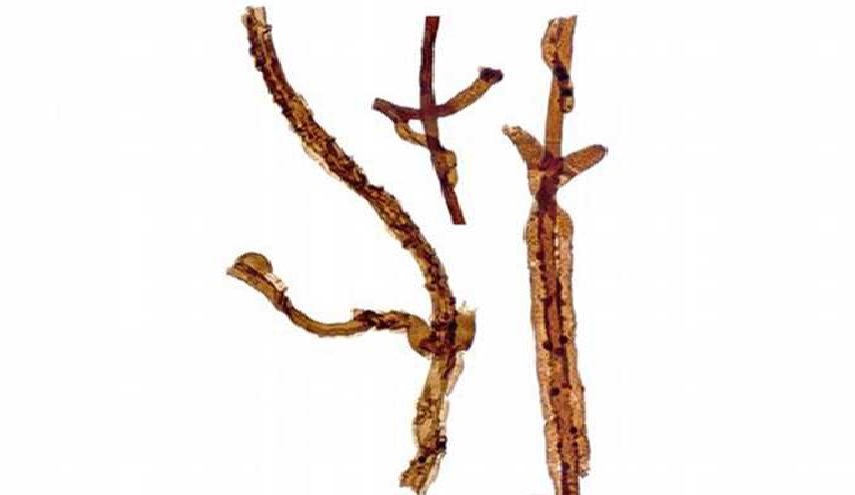 فطر عجيب يحمل لقب أقدم كائن حي على وجه البسيطة