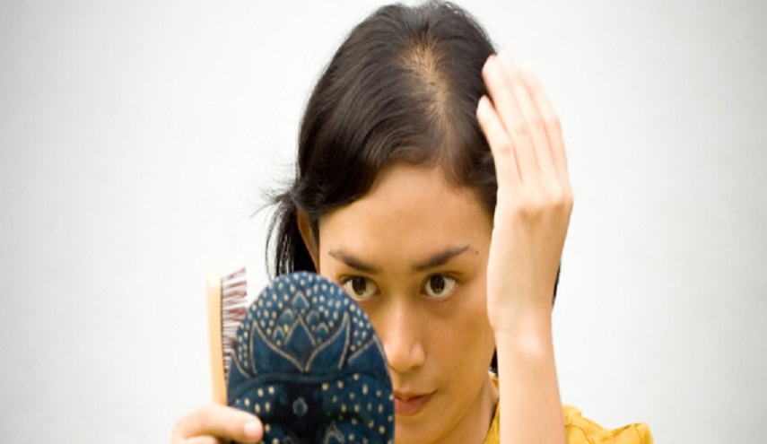 بالصور.. تساقط الشعر ليس دائماً وراثياً.. وهذه الأطعمة تحميك من الصلع؟