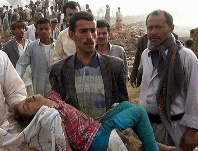 جريمة ثانية لطيران العدوان السعودي في باقم بصعدة