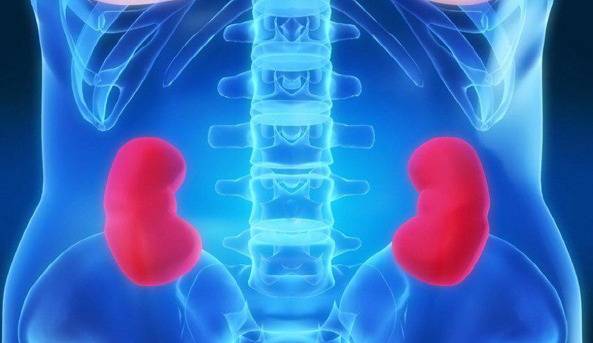 بدون أدوية... علاج منزلي لتفتيت حصى الكلى