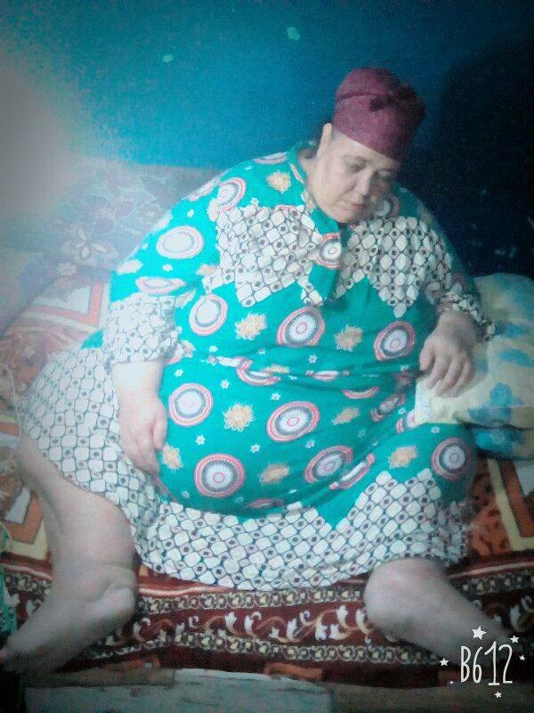 مرة أخرى .. مصرية في مأساة أسمن امرأة في العالم