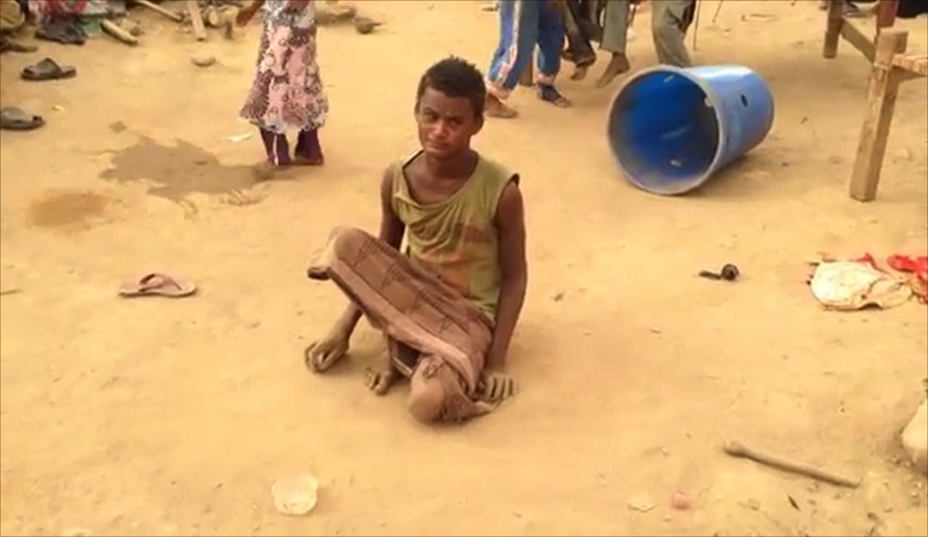 الامم المتحدة: مايحصل في اليمن كارثي