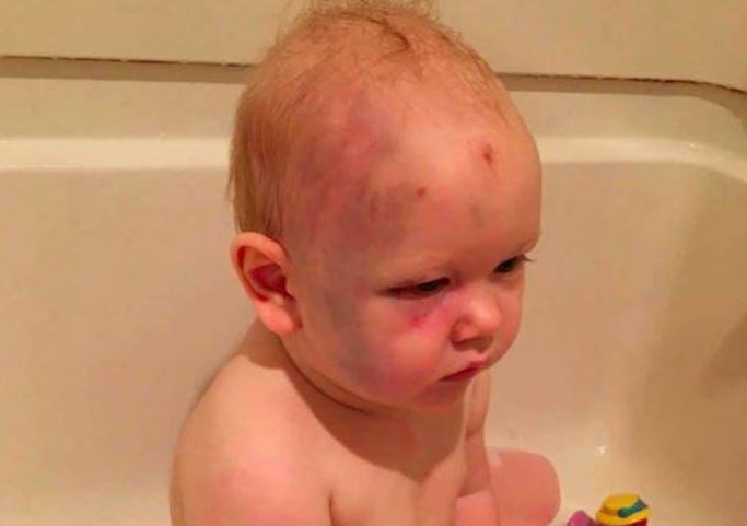 هذا الرضيع أشعل فيسبوك مؤخراَ والسبب كارثي!