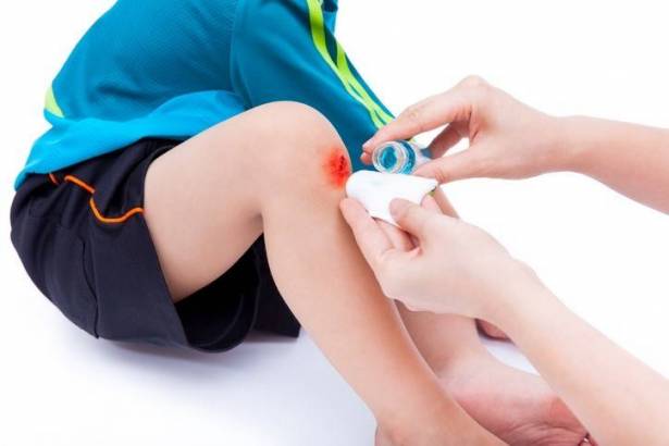 هكذا تتم معالجة الجروح السطحية منزلياً