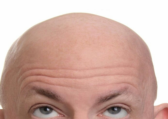 خبر صادم للرجل الاصلع او صاحب الشعر الرمادي!