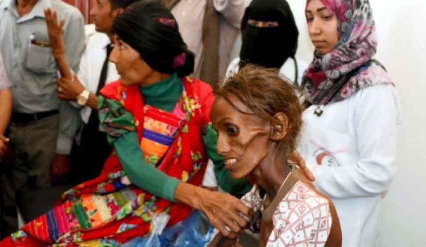 المجاعة تهدد اليمن اكثر من اي وقت مضى