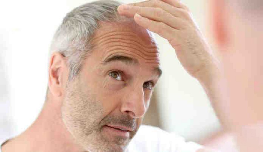 اليكم .. أهم أسباب الصلع والشيب !؟